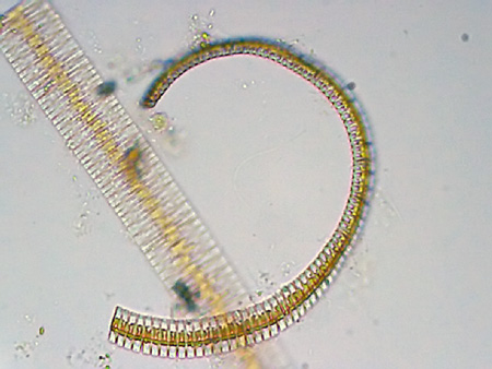 Fragilaria sp