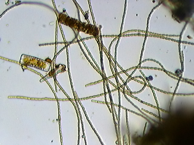 Anabaena sp