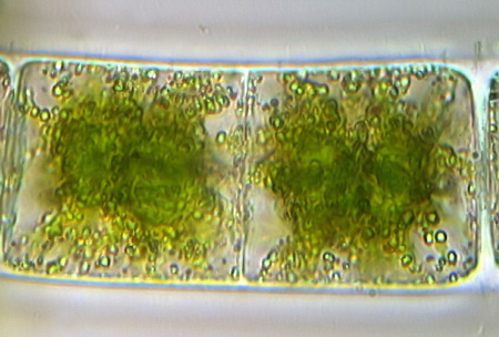 Zygnema sp