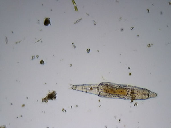 Philodina sp