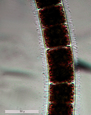 Zygnema sp