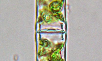 Spirogyra sp