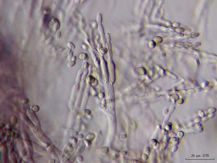 Penicillium sp