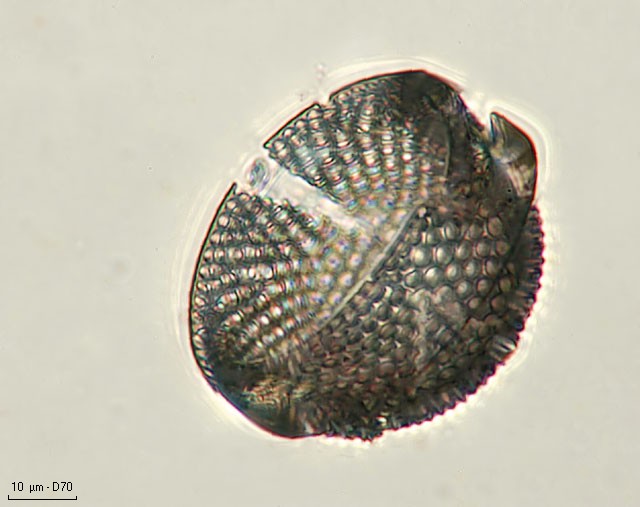 Pyxidicula sp