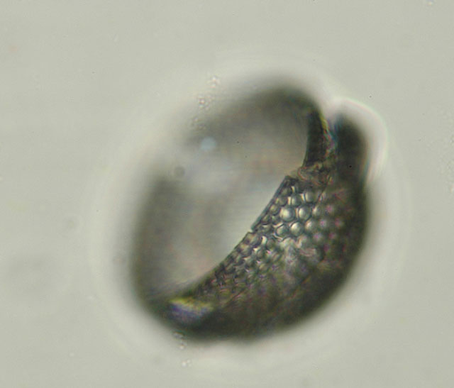 Pyxidicula sp