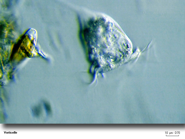 Vorticella sp