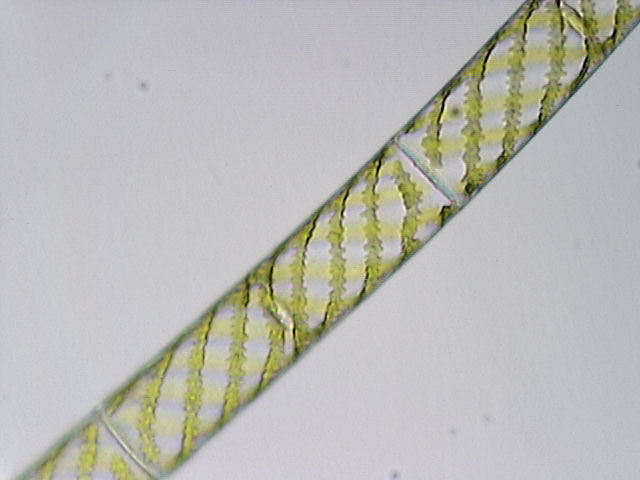 Spirogyra sp