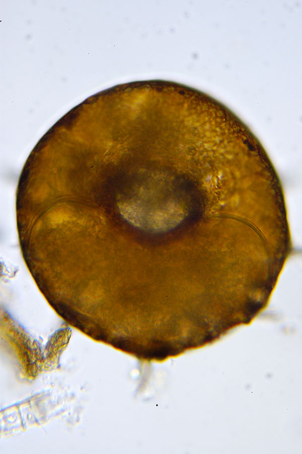 Arcella sp