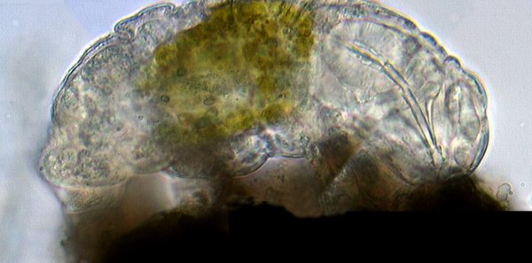 Tardigrade sp