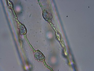 Spirogyra sp