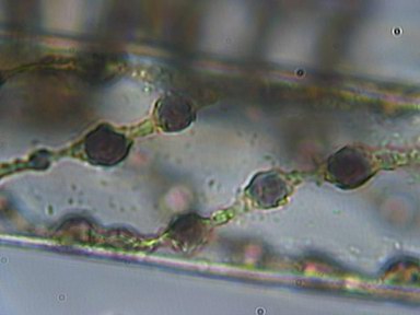 Spirogyra sp