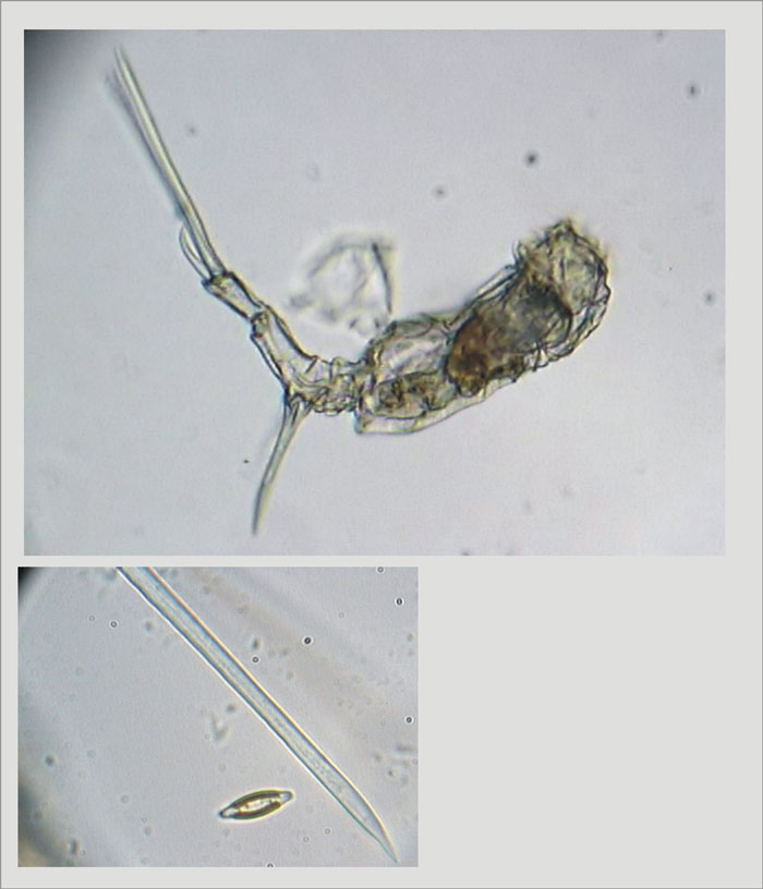 Trichotria pocillum